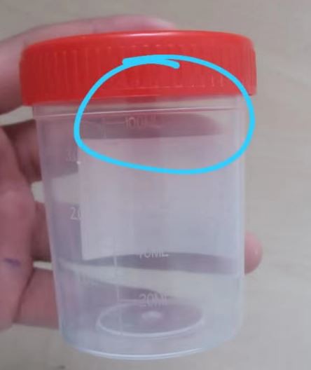 Urine Container 60ml