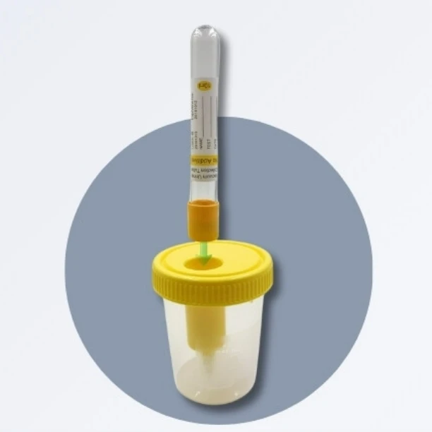 Vacuum Urine Specimen Cups 20ml-150ml